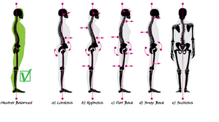 Healthy Habits: Posture Correction